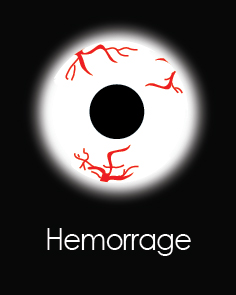 Featured image for “Haemorrage”